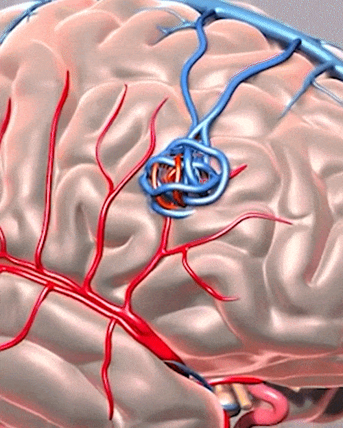 Neuro GIF