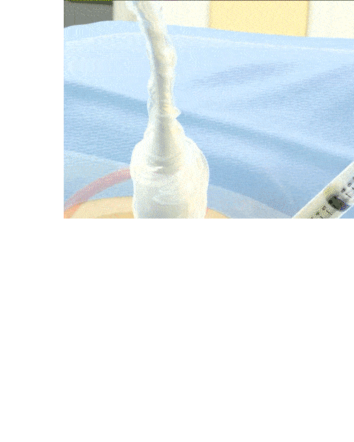 Gastro GIF