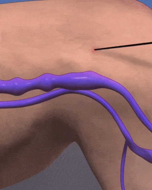 Perip GIF