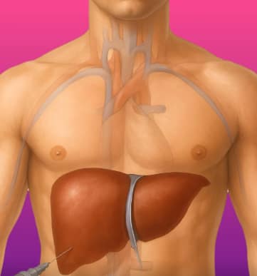 Gastrointestinal Hepatobilier