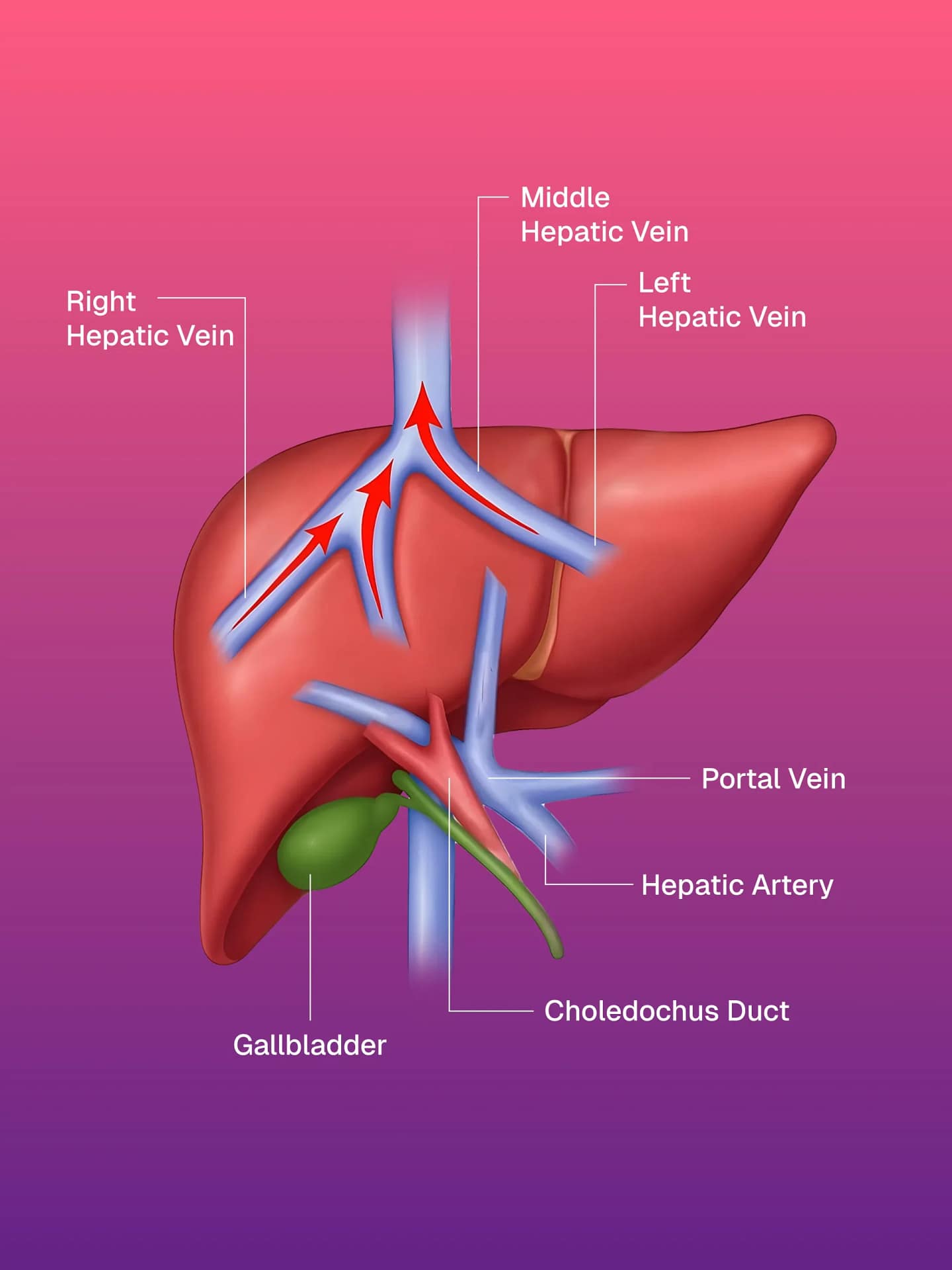 IVC Stentleme
