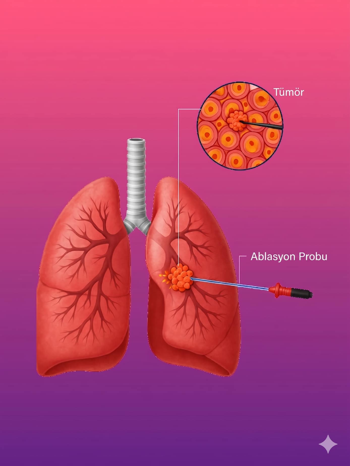 PICC Line