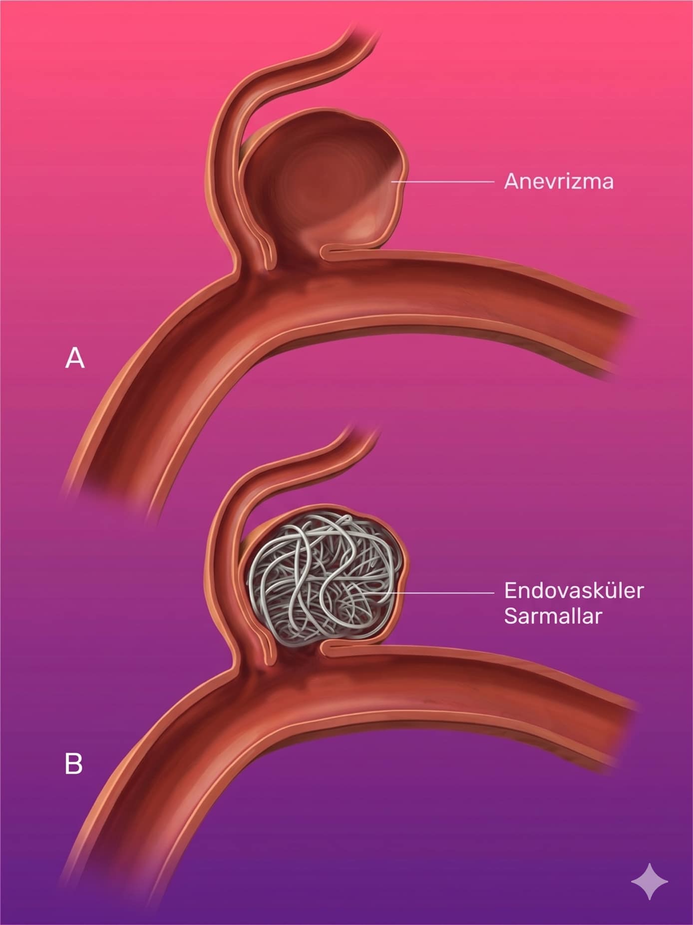 PICC Line