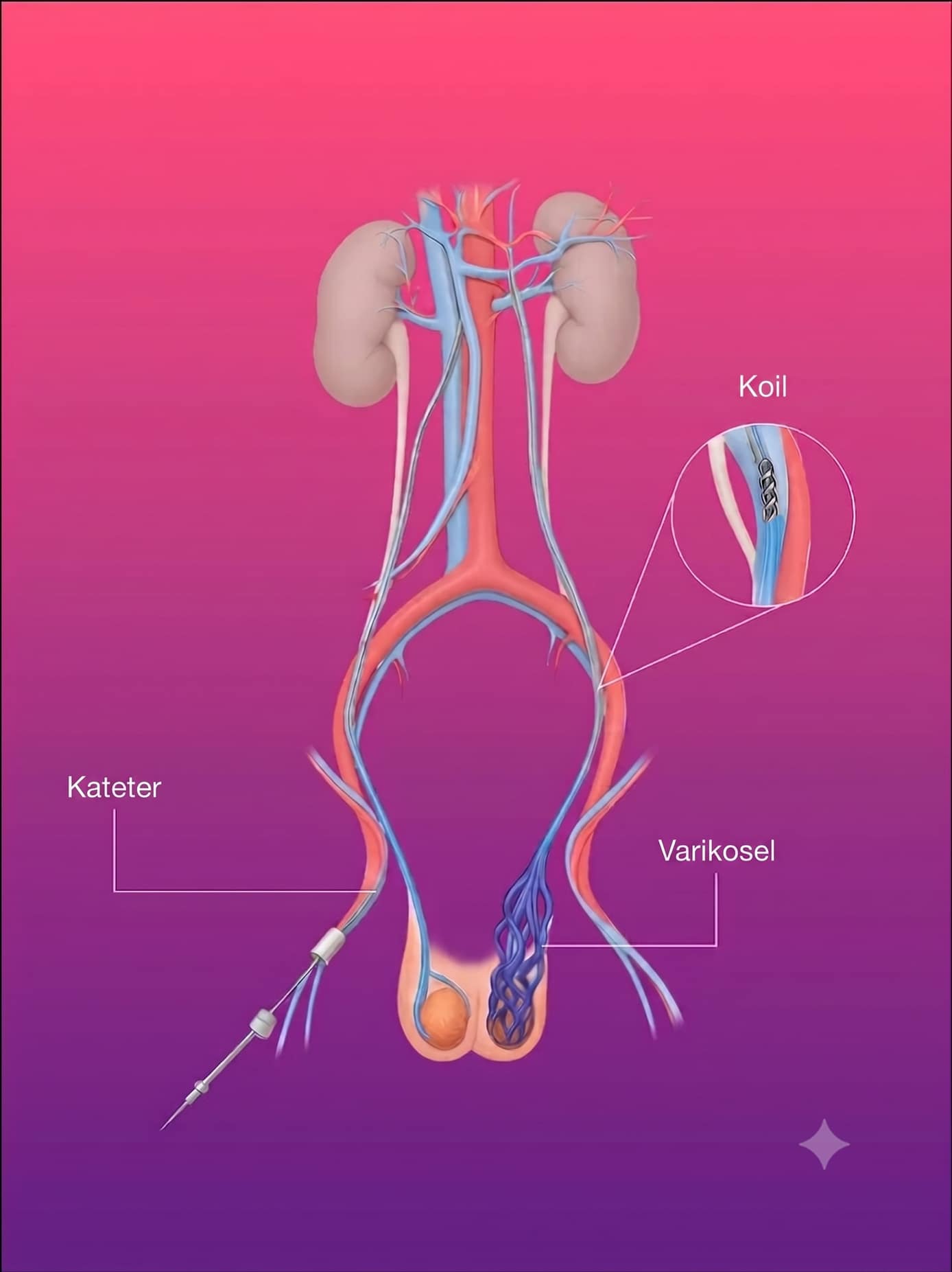 PICC Line